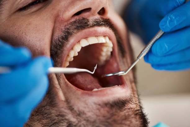 Best Emergency Denture Repair in Byron, CA
